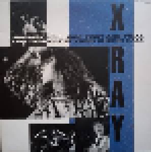 Cover - X-Ray: First And Final Live Concert